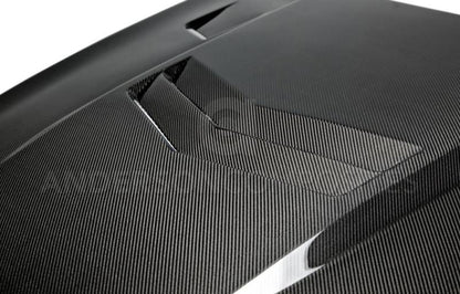Anderson Composites 13-15 Cadillac ATS Type-VT Hood AC-HD13CAATS-VT AC-HD13CAATS-VT User 4