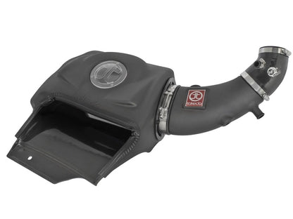 aFe Takeda Momentum GT Pro DRY S Cold Air Intake System: Honda S2000 (AP1/ TM-1023B-D Photo - Primary