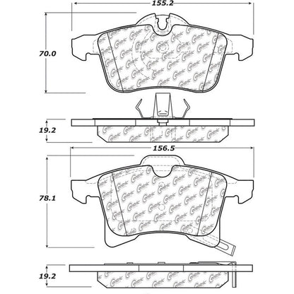 Centric Parts Disc Brake Pad Set Posi Quiet Ceramic with Shims for 2000-2008 Chevrolet Astra, 2007-2008 Meriva, 2006 Zafira, 2020-2022 Mercedes-Benz Metris 105.13610