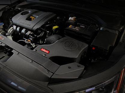 aFe Takeda Momentum Pro 5R Cold Air Intake System 16-20 Hyundai Elantra  L4-2.0L 56-70024R 56-70024R Photo - Mounted