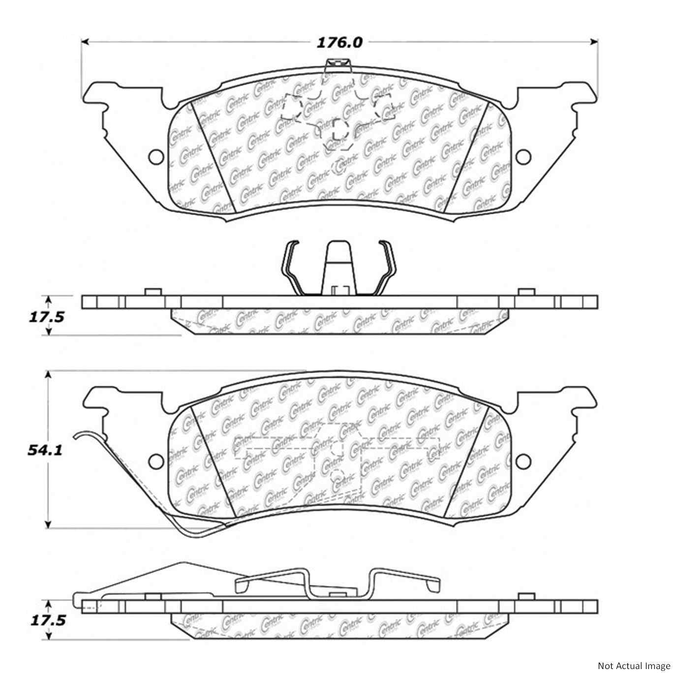 Posi Quiet Semi-Metallic Brake Pads with Hardware  top view frsport 104.05290